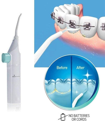 Portable Water Flosser
